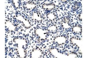 POP4 antibody was used for immunohistochemistry at a concentration of 4-8 ug/ml to stain Alveolar cells (arrows) in Human Lung.
