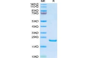 AGR2 Protein (AA 21-175) (His tag)