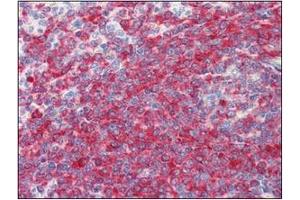 Immunohistochemistry (IHC) image for anti-Programmed Cell Death 4 (PDCD4) (AA 1-469), (N-Term) antibody (ABIN317548) (PDCD4 antibody  (N-Term))