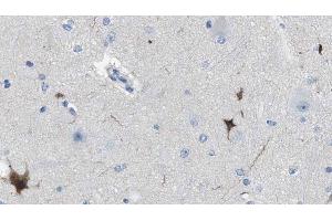 ABIN6274610 at 1/100 staining Human brain cancer tissue by IHC-P. (Cell Adhesion Molecule 4 antibody  (C-Term))