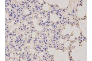 Immunohistochemistry (IHC) image for anti-Lipopolysaccharide-Induced Tumor Necrosis Factor-alpha Factor (LITAF) antibody (ABIN1876657) (LITAF antibody)