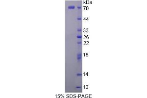 Image no. 1 for Platelet-Derived Growth Factor Receptor-Like (PDGFRL) (AA 22-375) protein (His tag,GST tag) (ABIN4989630)