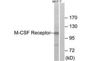 Western blot analysis of extracts from MCF7 cells, using M-CSF Receptor (Ab-723) Antibody. (CSF1R antibody  (AA 691-740))