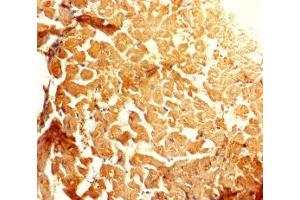 Immunohistochemistry of paraffin-embedded human heart tissue using ABIN7143697 at dilution of 1:100 (GALM antibody  (AA 2-342))