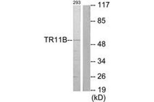 Western blot analysis of extracts from 293 cells, using TR11B Antibody . (Osteoprotegerin antibody  (AA 10-59))