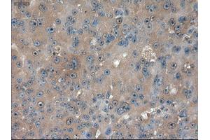 Immunohistochemical staining of paraffin-embedded kidney using anti-PTCH1 (ABIN2452537) mouse monoclonal antibody. (Patched 1 antibody  (AA 122-436))