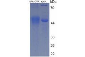 Image no. 2 for Heparanase (HPSE) protein (Ovalbumin) (ABIN2127414) (HPSE Protein (Ovalbumin))