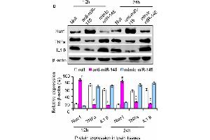The axis signaling of miR-145-5p-Nurr1-TNF-α in acute MCAO/R model of rats by in vivo expriments.
