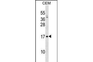 VPREB1 Antibody (Center) (ABIN1538592 and ABIN2838302) western blot analysis in CEM cell line lysates (35 μg/lane). (VPREB1 antibody  (AA 71-99))