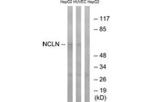 Western blot analysis of extracts from HepG2/HuvEc cells, using NCLN Antibody. (Nicalin antibody  (AA 474-523))