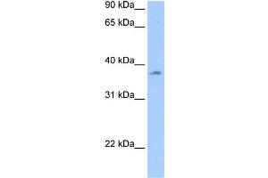 WB Suggested Anti-RBMY1A1 Antibody Titration:  0. (RBMY1A1 antibody  (N-Term))