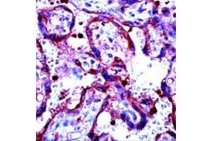 Immunohistochemical staining of human placenta stained with MMP9 polyclonal antibody  at 1 : 100 for 10 min at RT. (MMP 9 antibody)
