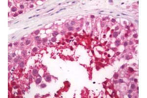 Human Testis: Formalin-Fixed, Paraffin-Embedded (FFPE)