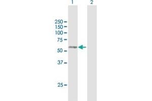 Western Blot analysis of RAB3IP expression in transfected 293T cell line by RAB3IP MaxPab polyclonal antibody. (RAB3IP antibody  (AA 1-460))