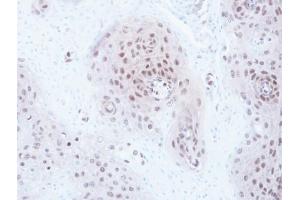 IHC-P Image Immunohistochemical analysis of paraffin-embedded A549 xenograft, using CSN1, antibody at 1:100 dilution.