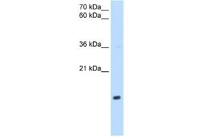 WB Suggested Anti-NDUFB5 Antibody Titration:  0. (NDUFB5 antibody  (Middle Region))
