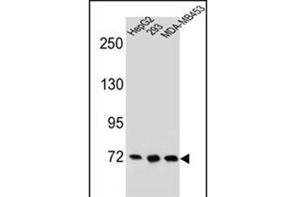 ZNF860 Antikörper  (C-Term)