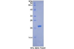 SDS-PAGE analysis of Rabbit BDNF Protein. (BDNF Protein)
