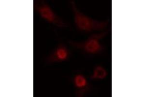ABIN6274267 staining COLO205 cells by IF/ICC. (CLK2 antibody  (N-Term))
