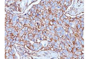 Image no. 1 for anti-CD44 Standard (CD44s) antibody (ABIN6151476) (CD44 Standard antibody)