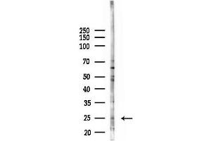 anti-Calmodulin-Like 6 (CALML6) antibody