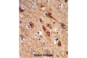 Formalin-fixed and paraffin-embedded human brain tissue reacted with ACCN1 Antibody (Center), which was peroxidase-conjugated to the secondary antibody, followed by DAB staining. (ACCN1 antibody  (Middle Region))