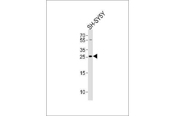 ZDHHC21 antibody  (N-Term)