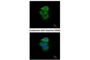 ICC/IF Image Immunofluorescence analysis of paraformaldehyde-fixed A549, using eIF2 alpha, antibody at 1:200 dilution. (EIF2A antibody  (Center))
