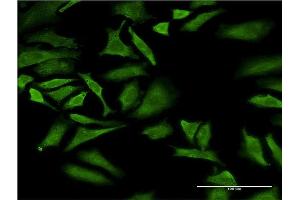 Immunofluorescence of monoclonal antibody to SWAP70 on HeLa cell. (SWAP70 antibody  (AA 378-451))