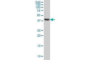 MGC13096 monoclonal antibody (M01), clone 5F9 Western Blot analysis of MGC13096 expression in HeLa . (PDCD2L antibody  (AA 80-179))