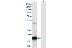 ZCCHC13 antibody  (AA 1-166)