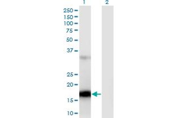 ZCCHC13 antibody  (AA 1-166)