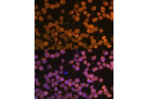 Immunofluorescence analysis of THP-1 cells using TNFRSF10A Polyclonal Antibody (ABIN6127583, ABIN6149301, ABIN6149303 and ABIN6216204) at dilution of 1:100 (40x lens).