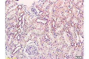 Formalin-fixed and paraffin embedded rat kidney tissue labeled Anti-KGF/FGF7 Polyclonal Antibody, Unconjugated (ABIN672501) at 1:300, followed by conjugation to the secondary antibody and DAB staining (FGF7 antibody  (AA 101-194))