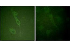 Immunofluorescence analysis of HuvEc cells, using IL-7R/CD127 (Phospho-Tyr449) Antibody. (IL7R antibody  (pTyr449))
