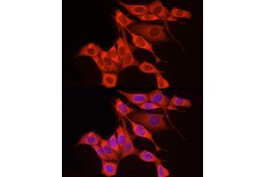 Immunofluorescence (IF) image for anti-Ribosomal Protein S18 (RPS18) (AA 1-152) antibody (ABIN6147205)