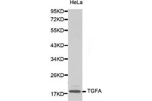 Western Blotting (WB) image for anti-Transforming Growth Factor, alpha (TGFA) (AA 24-98) antibody (ABIN3020948) (TGFA antibody  (AA 24-98))