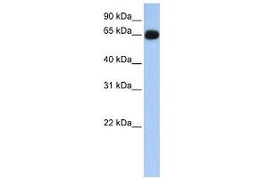 ALAS1 antibody used at 1 ug/ml to detect target protein. (ALAS1 antibody  (N-Term))