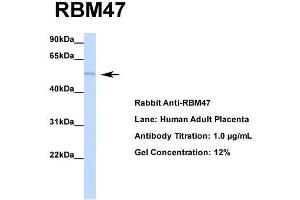 Host: Rabbit  Target Name: RBM47  Sample Tissue: Human Adult Placenta  Antibody Dilution: 1. (RBM47 antibody  (Middle Region))