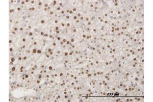 Immunoperoxidase of monoclonal antibody to SMAD6 on formalin-fixed paraffin-embedded human liver. (SMAD6 antibody  (AA 285-384))