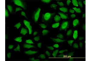 Immunofluorescence of monoclonal antibody to RRM2 on HeLa cell. (RRM2 antibody  (AA 1-110))