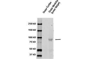 Western blot analysis of Rat kidney tissue lysates showing detection of ENaC protein using Rabbit Anti-ENaC Polyclonal Antibody . (SCNN1A antibody  (AA 617-638) (FITC))