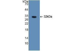 Western blot analysis of recombinant Human FOXO3. (FOXO3 antibody  (AA 369-633))