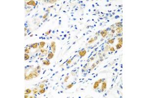Immunohistochemistry of paraffin-embedded human stomach using BLVRB antibody (ABIN5975104) at dilution of 1/100 (40x lens). (BLVRB antibody)