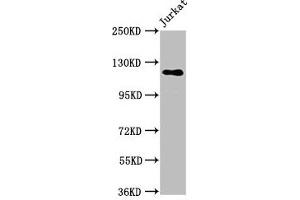 Western Blot Positive WB detected in: Jurkat whole cell lysate All lanes: SREBF1 antibody at 5.