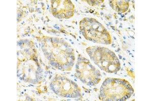 Immunohistochemistry of paraffin-embedded Mouse stomach using SULT2A1 Polyclonal Antibody at dilution of 1:200 (40x lens). (SULT2A1 antibody)