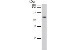 Detection of cytokeratin 8 in HeLa cell lysate by mouse monoclonal antibody C-51 .
