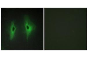 Immunofluorescence analysis of HeLa cells, using DGKH antibody. (DGKH antibody  (Internal Region))