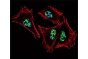Fluorescent confocal image of A2058 cell stained with PROX1 antibody at 1:25. (PROX1 antibody  (AA 492-522))