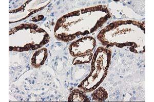 Immunohistochemical staining of paraffin-embedded Human Kidney tissue using anti-NNMT mouse monoclonal antibody. (NNMT antibody)